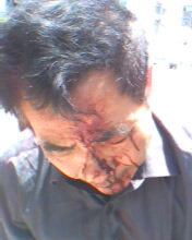 康复医院的保安上班时间殴打老弱病残 - 百姓话