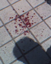 康复医院的保安上班时间殴打老弱病残 - 百姓话