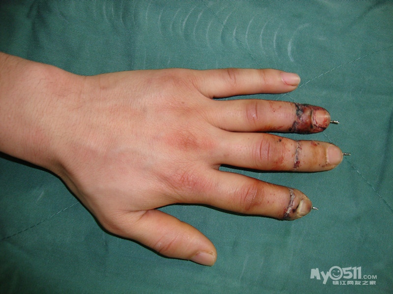 手足外科第一诊室---三五九医院 - 寻医问药 - 梦