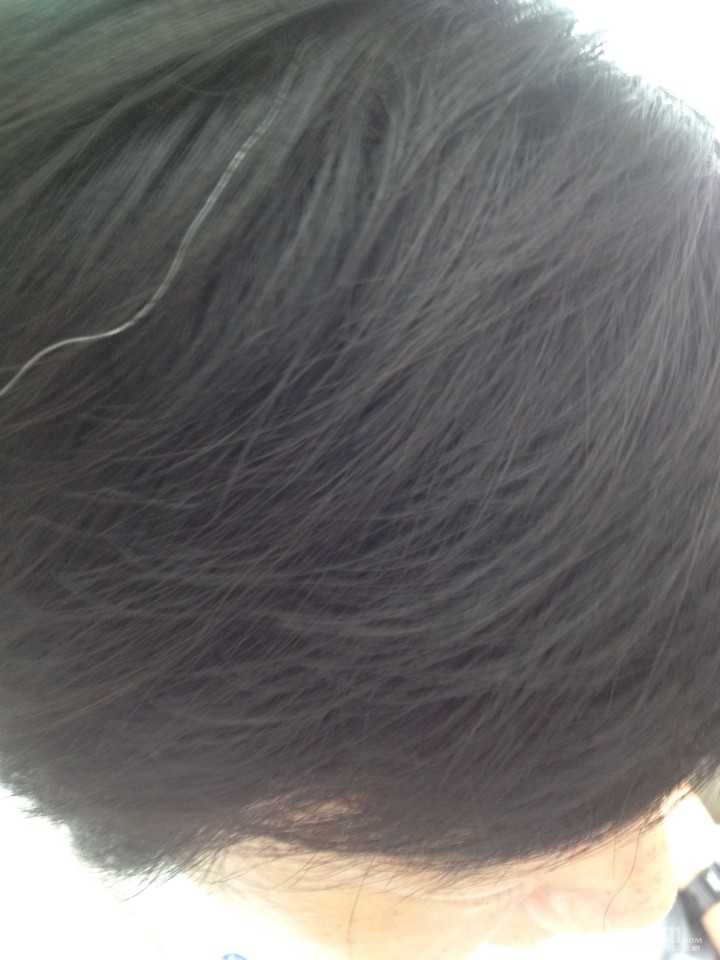 我老了,这么<em>长</em>的<em>白头发</em>出来了! - 茶余饭后 - 梦