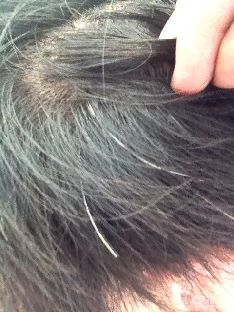 我老了,这么<em>长</em>的<em>白头发</em>出来了! - 茶余饭后 - 梦