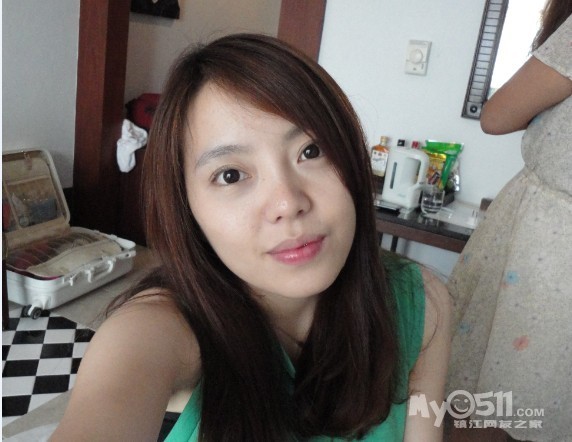 Goodbye baby face 再见圆圆脸---整牙脸型前后