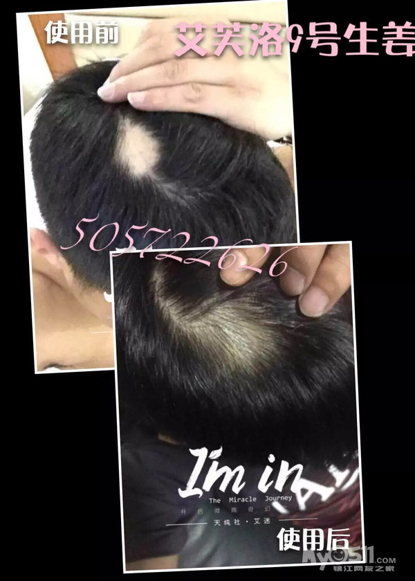 艾芙洛专卖店头油<em>头痒</em>、头屑、干枯毛躁、烫染