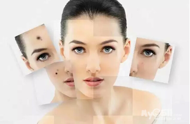 小女孩点痣变黑色瘤!医生:孩子身上有痣别轻易