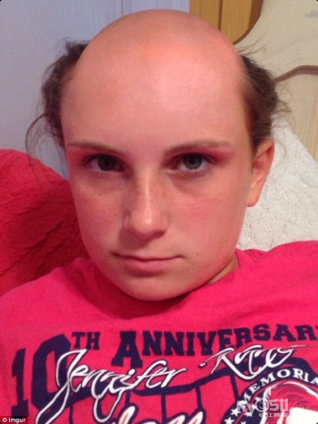 美女误把脱毛膏当洗发水 头顶秒变地中海 - 百