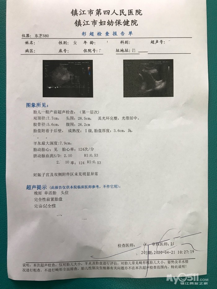 有什么好孕经验要对备孕妹子说:用排卵试纸或者去医院监测排卵都是有