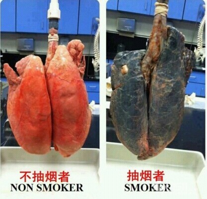 震惊的对比:【彩照】抽烟者与不抽烟者的肺