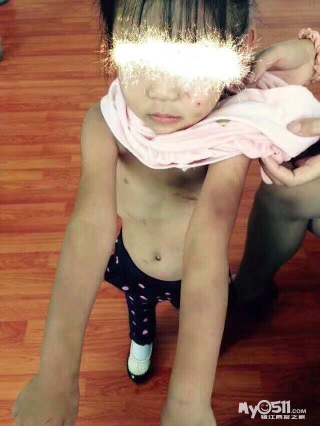 关于镇江高资6岁女孩被虐的真相!(真相在569楼)